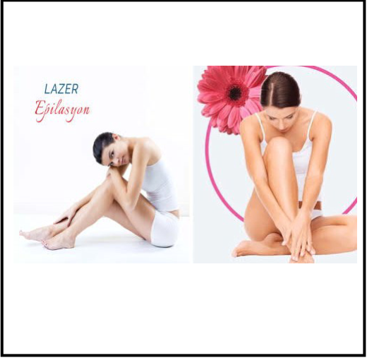 LAZER EPİLASYON