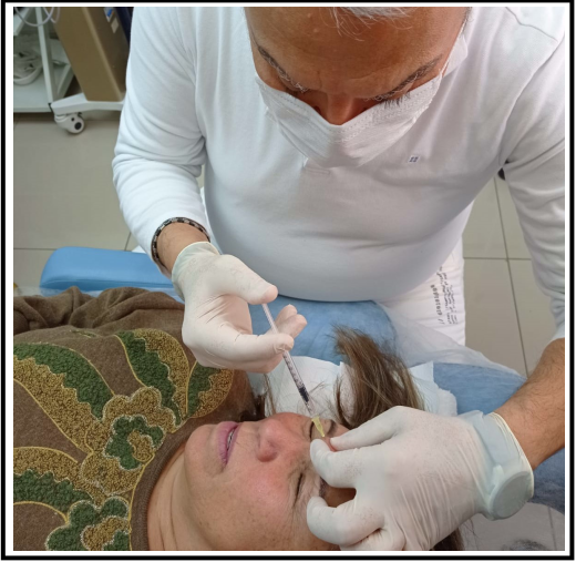 BOTOX 