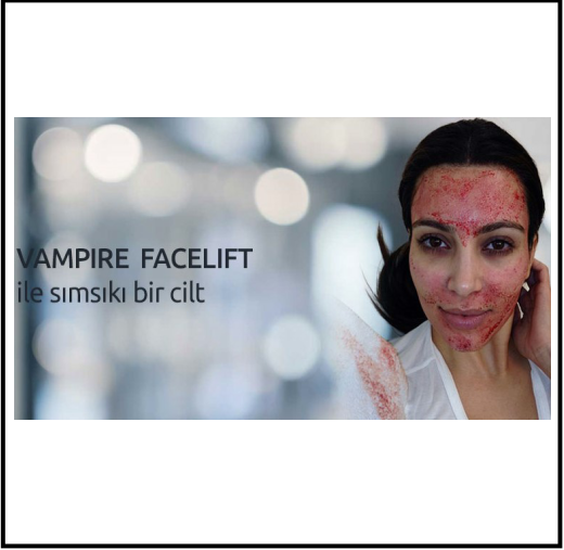 MAGELLAN VAMPİRE FACELİFT